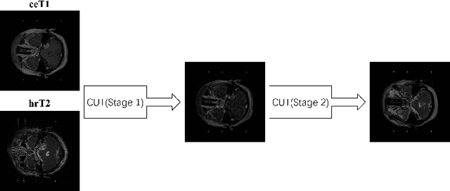 Figure 1 for Weakly Unsupervised Domain Adaptation for Vestibular Schwannoma Segmentation