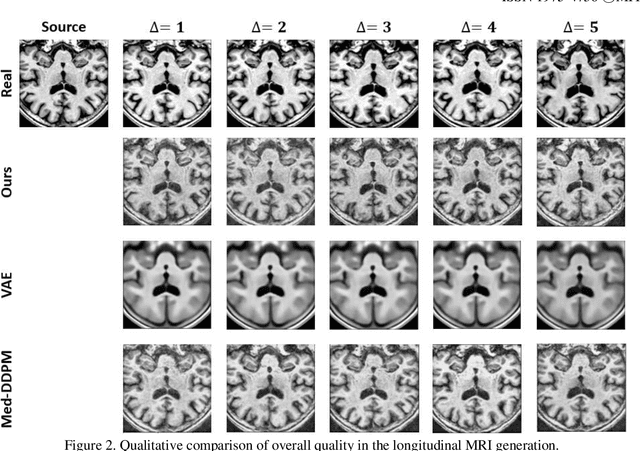 Figure 2 for Conditional Diffusion Model for Longitudinal Medical Image Generation