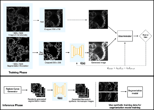 Figure 3 for A Conditional Generative Framework for Synthetic Data Augmentation in Segmenting Thin and Elongated Structures in Biological Images