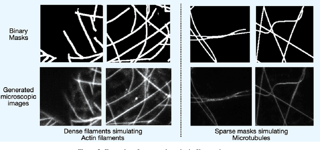 Figure 4 for A Conditional Generative Framework for Synthetic Data Augmentation in Segmenting Thin and Elongated Structures in Biological Images