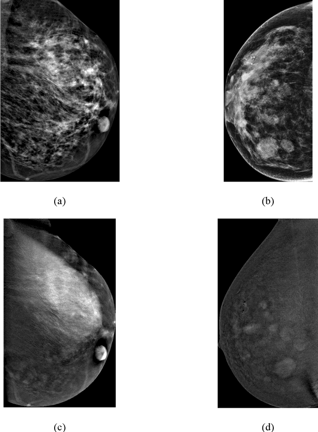 Figure 3 for Efficient Medical Image Retrieval Using DenseNet and FAISS for BIRADS Classification