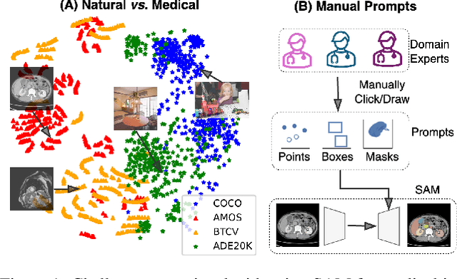 Figure 1 for Auto-Prompting SAM for Mobile Friendly 3D Medical Image Segmentation
