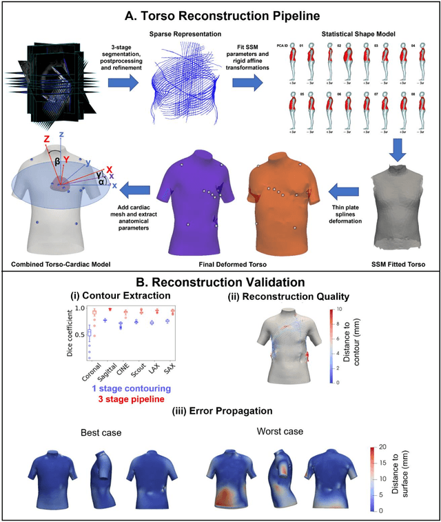 Figure 1 for Anatomical basis of sex differences in human post-myocardial infarction ECG phenotypes identified by novel automated torso-cardiac 3D reconstruction