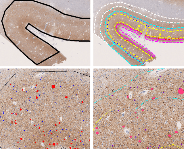 Figure 2 for Graph Theory and GNNs to Unravel the Topographical Organization of Brain Lesions in Variants of Alzheimer's Disease Progression