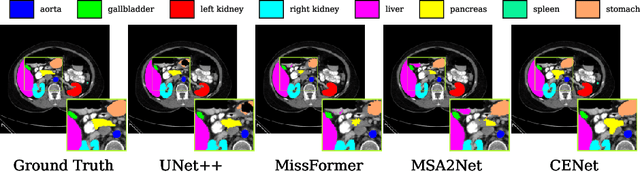 Figure 3 for CENet: Context Enhancement Network for Medical Image Segmentation