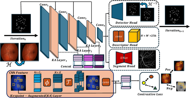 Figure 1 for Retinal IPA: Iterative KeyPoints Alignment for Multimodal Retinal Imaging