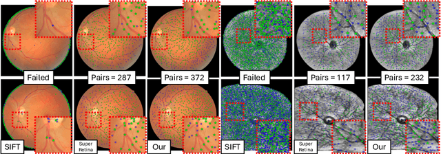 Figure 3 for Retinal IPA: Iterative KeyPoints Alignment for Multimodal Retinal Imaging