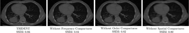 Figure 1 for TRIDENT: The Nonlinear Trilogy for Implicit Neural Representations
