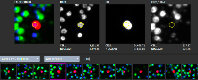 Figure 1 for Fully Automated CTC Detection, Segmentation and Classification for Multi-Channel IF Imaging