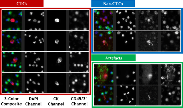 Figure 4 for Fully Automated CTC Detection, Segmentation and Classification for Multi-Channel IF Imaging