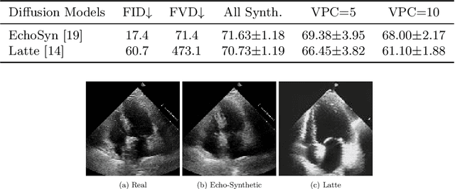 Figure 4 for InfoMotion: A Graph-Based Approach to Video Dataset Distillation for Echocardiography