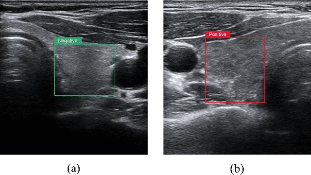 Figure 1 for Texture Classification Network Integrating Adaptive Wavelet Transform