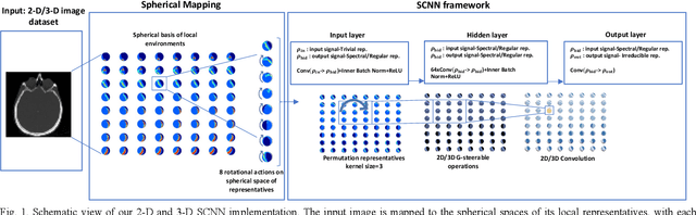 Figure 1 for Equivariant Spherical CNN for Data Efficient and High-Performance Medical Image Processing