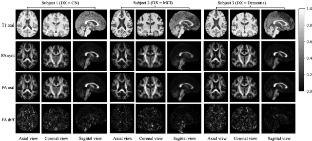 Figure 2 for Diffusion Bridge Models for 3D Medical Image Translation