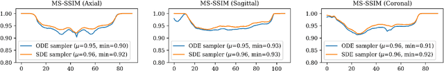 Figure 3 for Diffusion Bridge Models for 3D Medical Image Translation