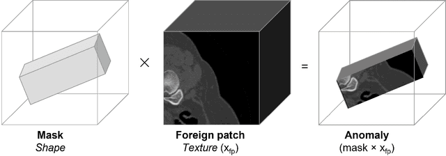 Figure 1 for Harder synthetic anomalies to improve OoD detection in Medical Images