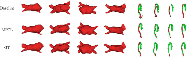 Figure 4 for Mixed Prototype Consistency Learning for Semi-supervised Medical Image Segmentation