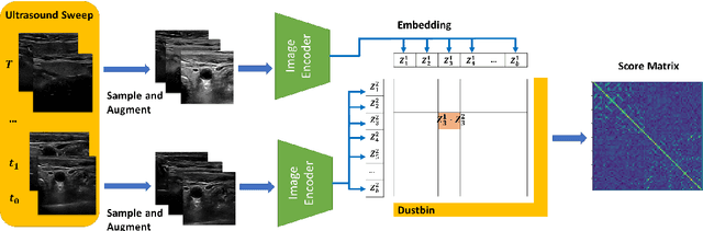 Figure 3 for Image Retrieval with Intra-Sweep Representation Learning for Neck Ultrasound Scanning Guidance