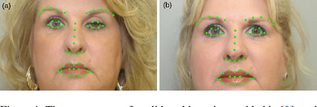 Figure 1 for Iterative Refinement Strategy for Automated Data Labeling: Facial Landmark Diagnosis in Medical Imaging