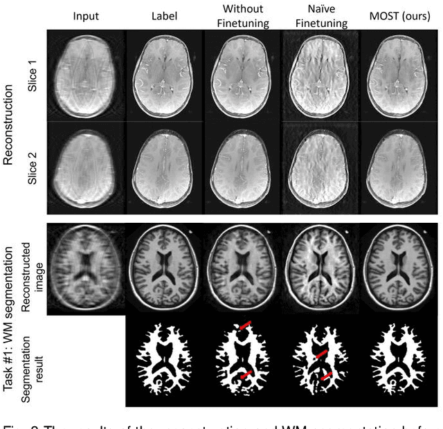 Figure 3 for MOST: MR reconstruction Optimization for multiple downStream Tasks via continual learning