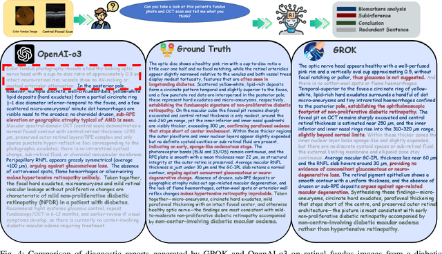 Figure 4 for GROK: From Quantitative Biomarkers to Qualitative Diagnosis via a Grounded MLLM with Knowledge-Guided Instruction