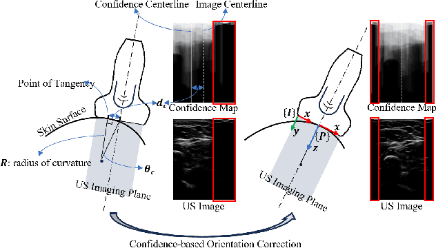 Figure 4 for Gaze-Guided Robotic Vascular Ultrasound Leveraging Human Intention Estimation