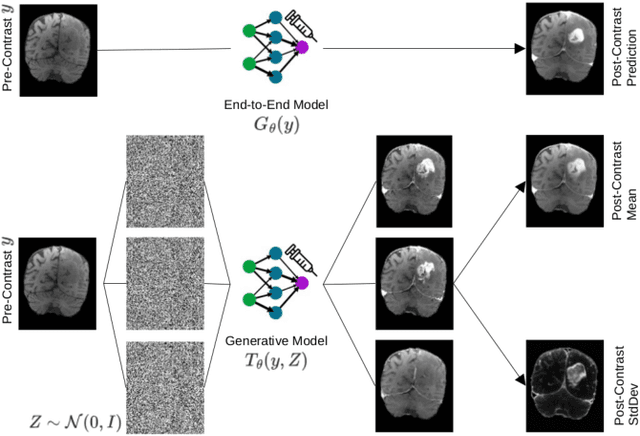 Figure 1 for Conditional Generative Models for Contrast-Enhanced Synthesis of T1w and T1 Maps in Brain MRI