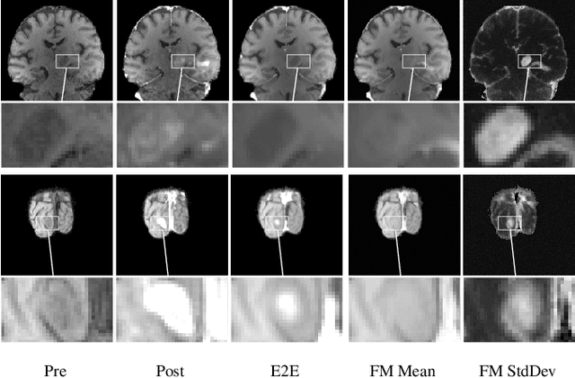 Figure 3 for Conditional Generative Models for Contrast-Enhanced Synthesis of T1w and T1 Maps in Brain MRI