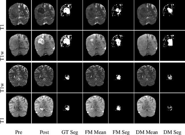 Figure 4 for Conditional Generative Models for Contrast-Enhanced Synthesis of T1w and T1 Maps in Brain MRI