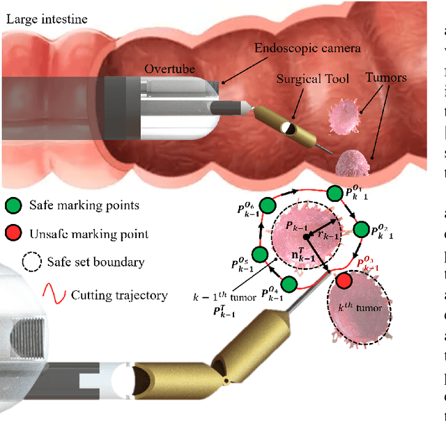 Figure 1 for Safety-Ensured Control Framework for Robotic Endoscopic Task Automation