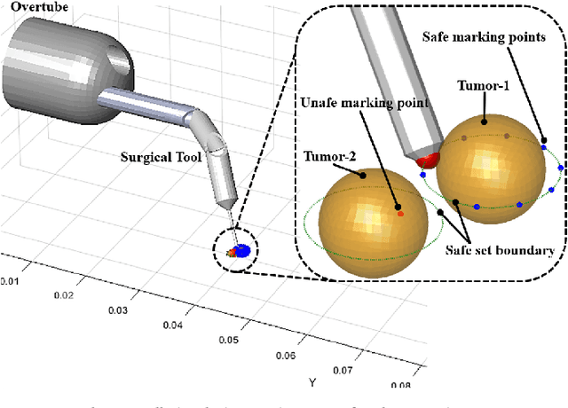 Figure 3 for Safety-Ensured Control Framework for Robotic Endoscopic Task Automation