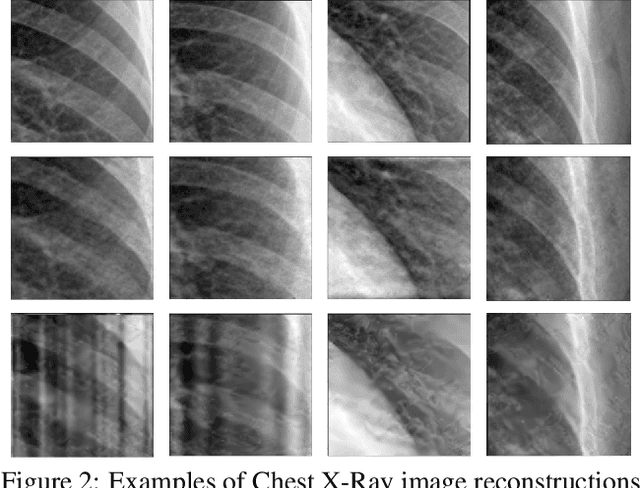 Figure 3 for Alternating Phase Langevin Sampling with Implicit Denoiser Priors for Phase Retrieval
