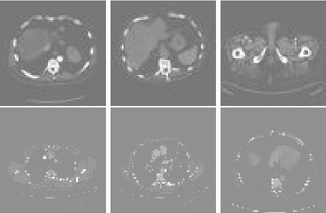 Figure 4 for Soft-Dropout: A Practical Approach for Mitigating Overfitting in Quantum Convolutional Neural Networks
