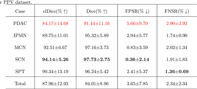 Figure 2 for Automated Peripancreatic Vessel Segmentation and Labeling Based on Iterative Trunk Growth and Weakly Supervised Mechanism