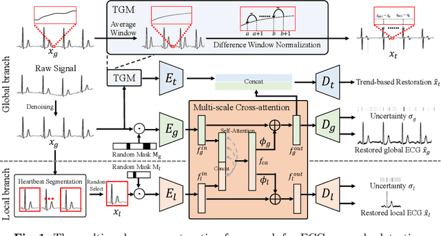 Figure 1 for Multi-scale Cross-restoration Framework for Electrocardiogram Anomaly Detection