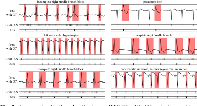 Figure 3 for Multi-scale Cross-restoration Framework for Electrocardiogram Anomaly Detection