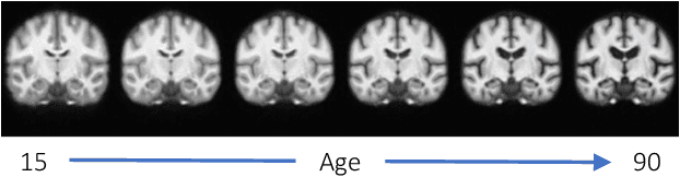 Figure 1 for AtlasMorph: Learning conditional deformable templates for brain MRI