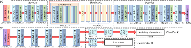 Figure 4 for Switchable deep beamformer for high-quality and real-time passive acoustic mapping