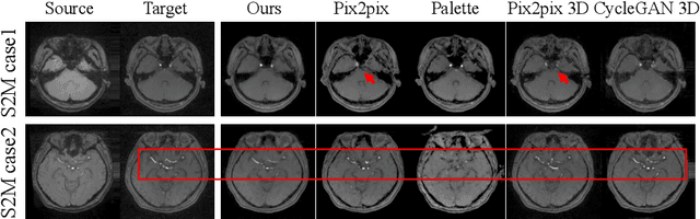 Figure 3 for Make-A-Volume: Leveraging Latent Diffusion Models for Cross-Modality 3D Brain MRI Synthesis