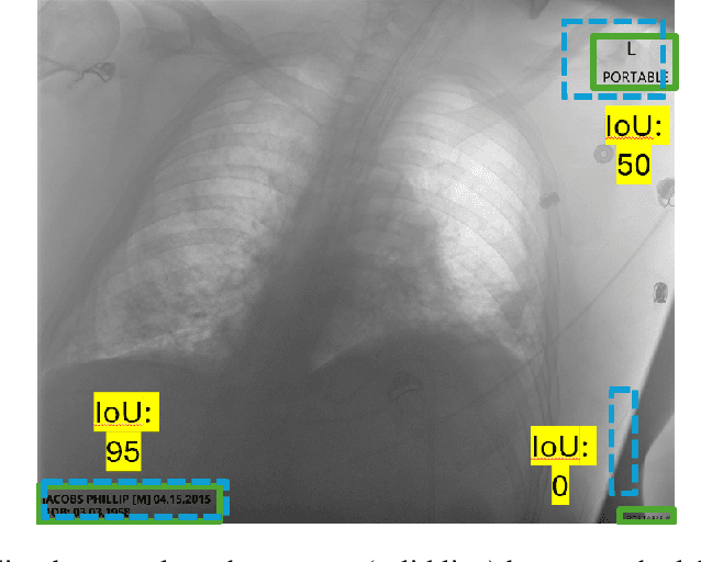 Figure 4 for DICOM De-Identification via Hybrid AI and Rule-Based Framework for Scalable, Uncertainty-Aware Redaction