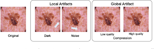 Figure 3 for Data AUDIT: Identifying Attribute Utility- and Detectability-Induced Bias in Task Models