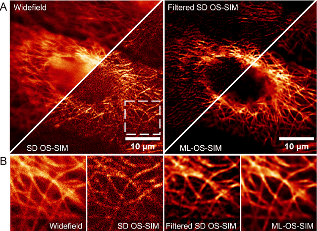 Figure 1 for Fast, multicolour optical sectioning over extended fields of view by combining interferometric SIM with machine learning