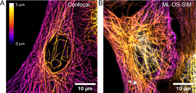 Figure 2 for Fast, multicolour optical sectioning over extended fields of view by combining interferometric SIM with machine learning