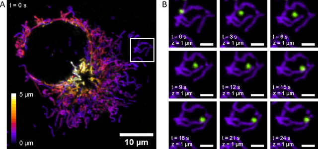 Figure 3 for Fast, multicolour optical sectioning over extended fields of view by combining interferometric SIM with machine learning