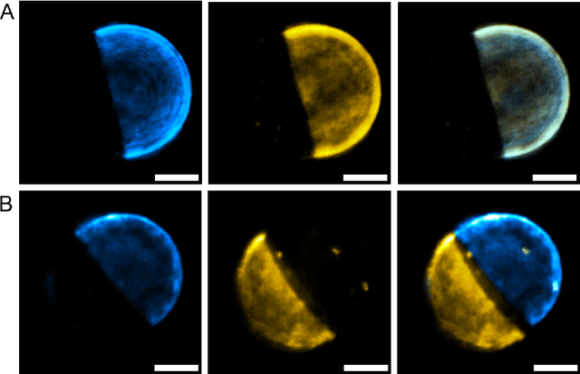 Figure 4 for Fast, multicolour optical sectioning over extended fields of view by combining interferometric SIM with machine learning