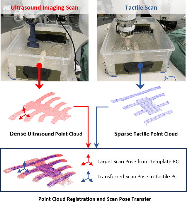 Figure 1 for Tactile-Guided Robotic Ultrasound: Mapping Preplanned Scan Paths for Intercostal Imaging