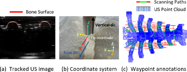 Figure 3 for Tactile-Guided Robotic Ultrasound: Mapping Preplanned Scan Paths for Intercostal Imaging