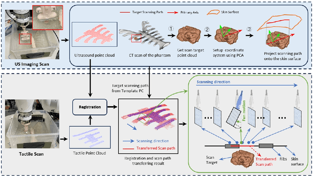 Figure 4 for Tactile-Guided Robotic Ultrasound: Mapping Preplanned Scan Paths for Intercostal Imaging