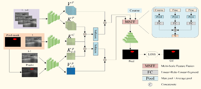 Figure 2 for A Spatial-Temporal Progressive Fusion Network for Breast Lesion Segmentation in Ultrasound Videos