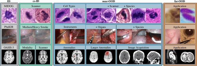 Figure 1 for OpenMIBOOD: Open Medical Imaging Benchmarks for Out-Of-Distribution Detection